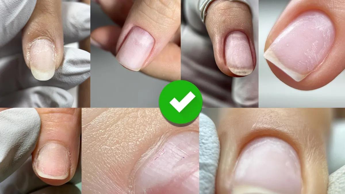 Ejemplo de práctica de manicura ucraniana enviada para revisión en Método CHYSTO